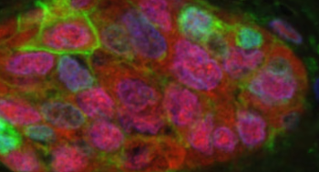 Las células envejecidas que escapan al sistema inmunológico: un hallazgo promete nuevas terapias