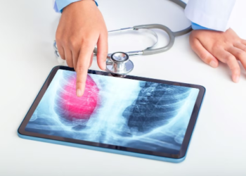 Crearon un dispositivo experimental que busca indicios del cáncer de pulmón en el aliento