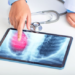 Crearon un dispositivo experimental que busca indicios del cáncer de pulmón en el aliento