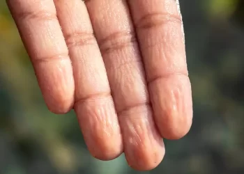 La pregunta de un niño desvela misterio de los dedos mojados