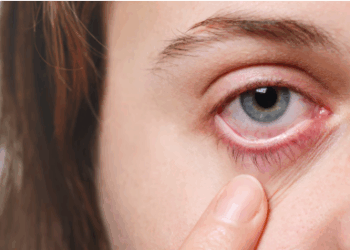 Ojo seco: causas más frecuentes, síntomas clave y cómo prevenir complicaciones