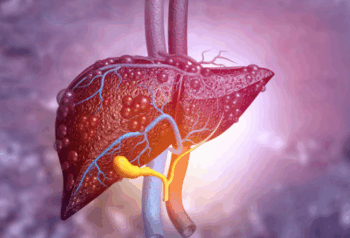 Cuál es el mineral clave para combatir el hígado graso y cómo consumirlo para reducir el porcentaje de grasa en el órgano